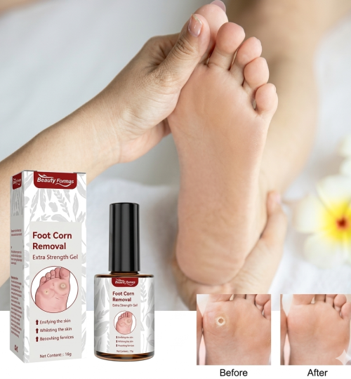 South Moon Foot Corns Exfoliating Gel Hand and Foot Wart Thorn Calluses Skin Smooth Repair and Cleaning 10 ml