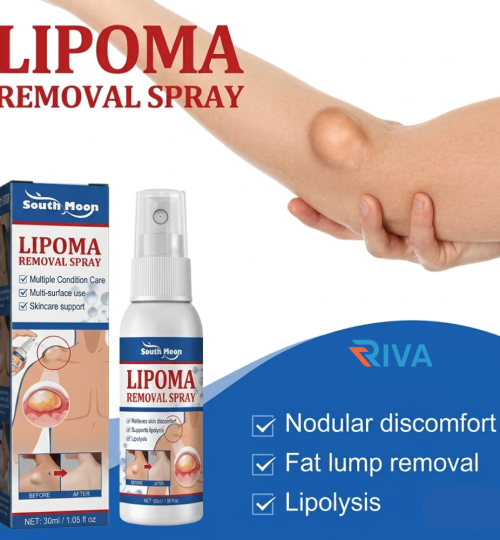 South Moon Lipoma Remover Spray Relief Lipolysis Fat Lump With Lipoma Spray 50 Ml
